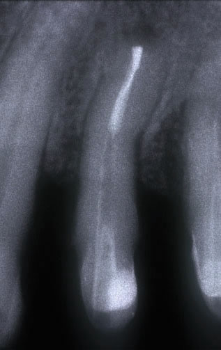 Endodonzia chirurgica