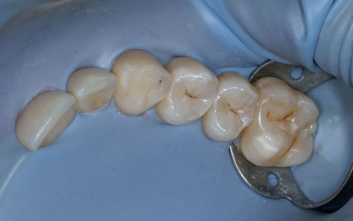 Endodonzia