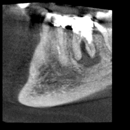Ortopantomografo / Tac Cone Beam