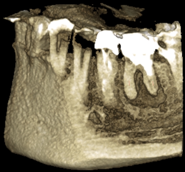 Ortopantomografo / Tac Cone Beam