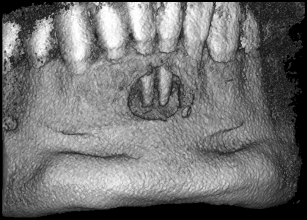 Ortopantomografo / Tac Cone Beam