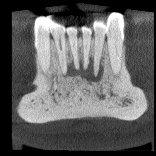 Ortopantomografo / Tac Cone Beam