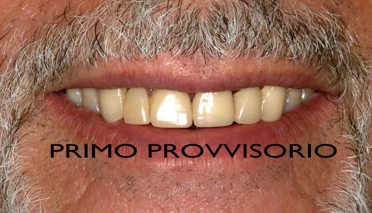 Provvisorio