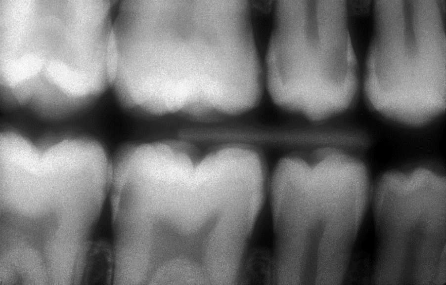 Il Radiografico