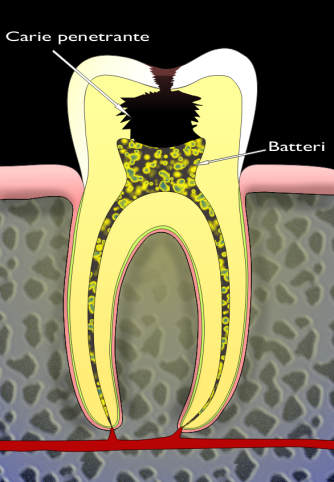 Endodonzia