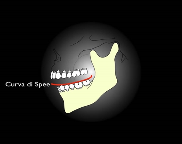 Occlusione