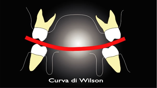Occlusione